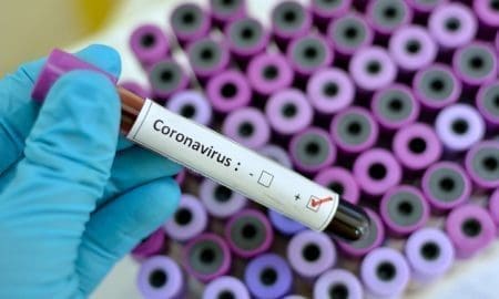 Melincué: Confirman tres nuevos casos positivos de Covid-19