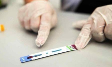 A mediados de agosto se volverían a hacer test rápidos de VIH en la provincia